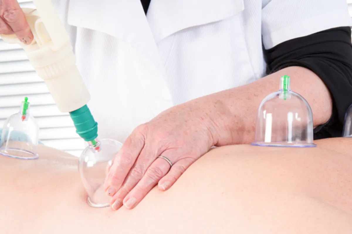 https://alriyadhmc.com/wp-content/uploads/2015/09/hijama-03.webp