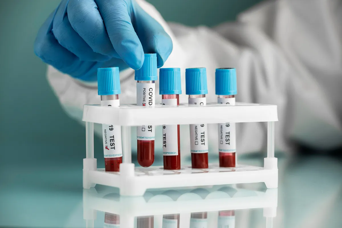 https://alriyadhmc.com/wp-content/uploads/2024/05/Phlebotomy2.webp