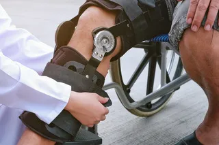 Prosthetics-Orthotics-.webp